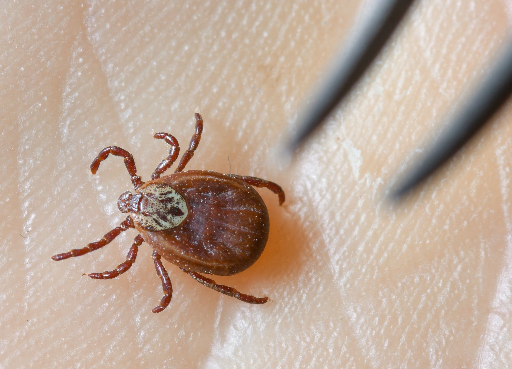 Zecken übertragen FSME und Borreliose. (Archivbild)