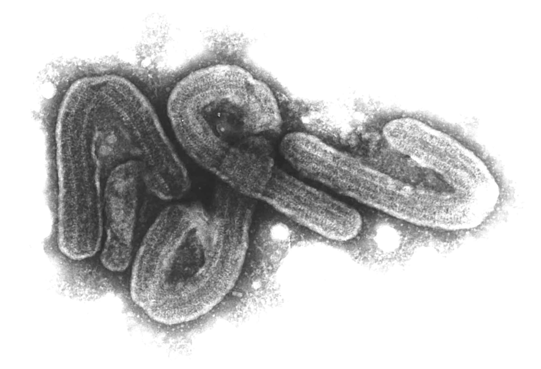 Eine elektronenmikroskopische Aufnahme des Marburg-Virus.