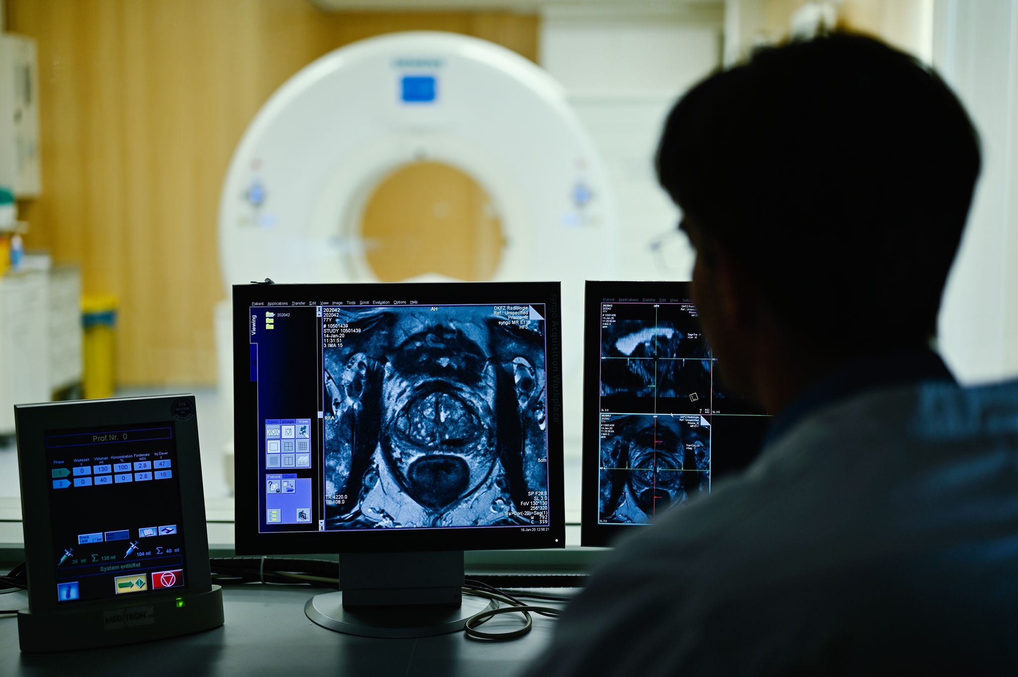 Nach dem Anfangsverdacht: Im Verlauf einer Diagnostik kommen auch bildgebende Verfahren zum Einsatz.