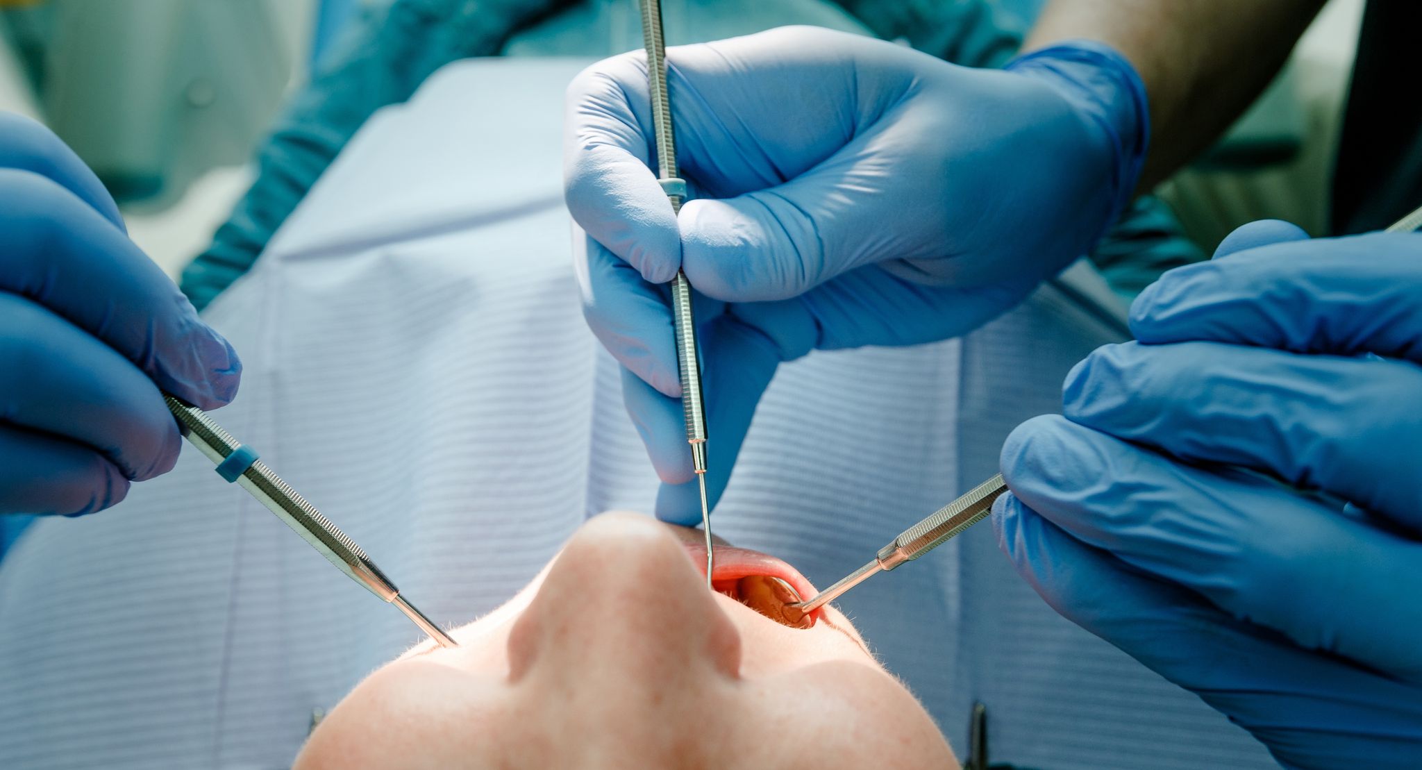 Zahnzusatzversicherungen früh abschließen: Ein früher Abschluss kann langfristig günstiger sein und Schutz vor hohen Kosten bieten.