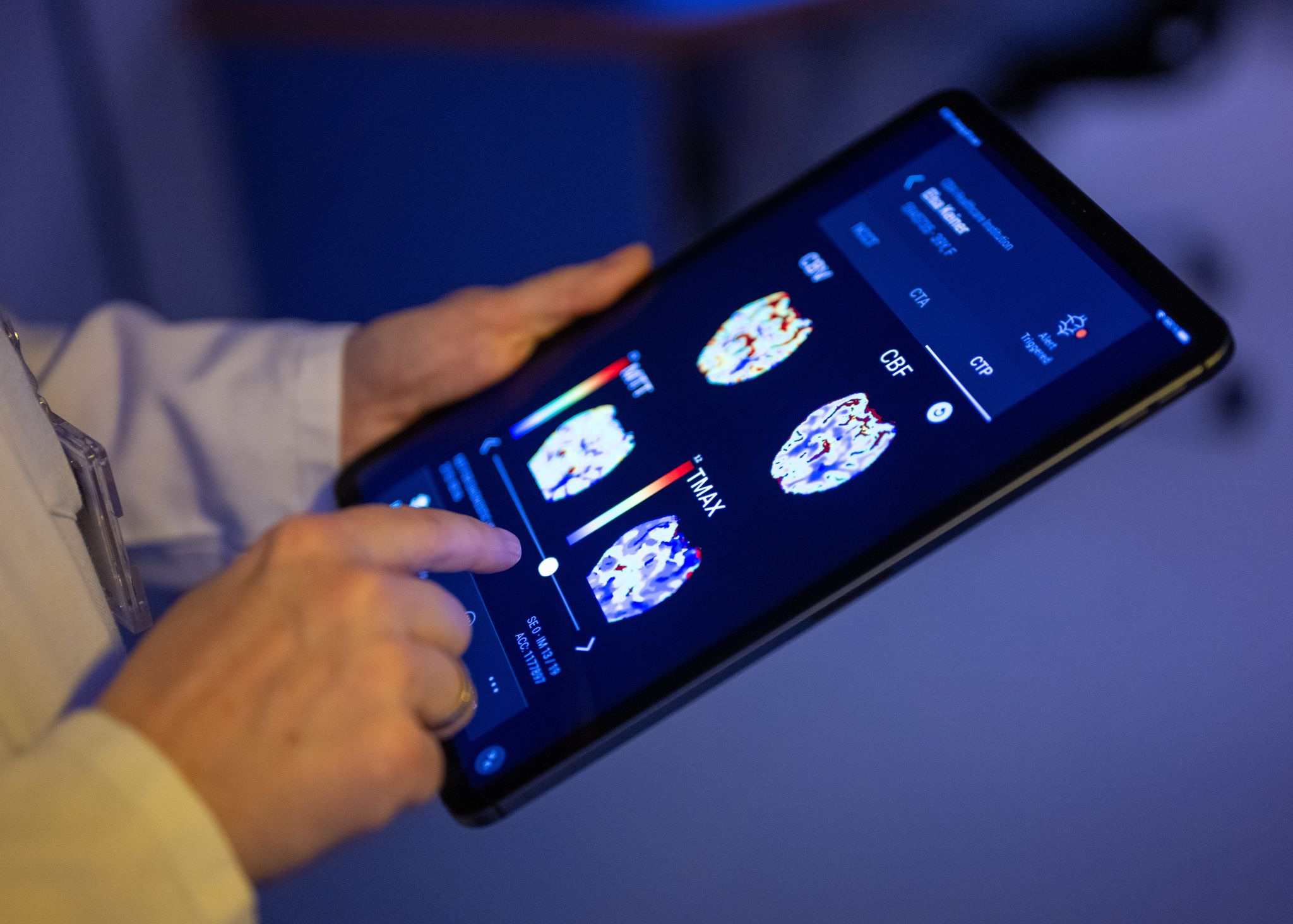 Gehirnbilder eines Patienten in einer KI-basierten App. Nach einer Deloitte-Umfrage sehen viele Bürgerinnen und Bürger den Einsatz von KI in der Medizin skeptisch, vor allem wenn es um die Therapie geht. (Symbolbild)